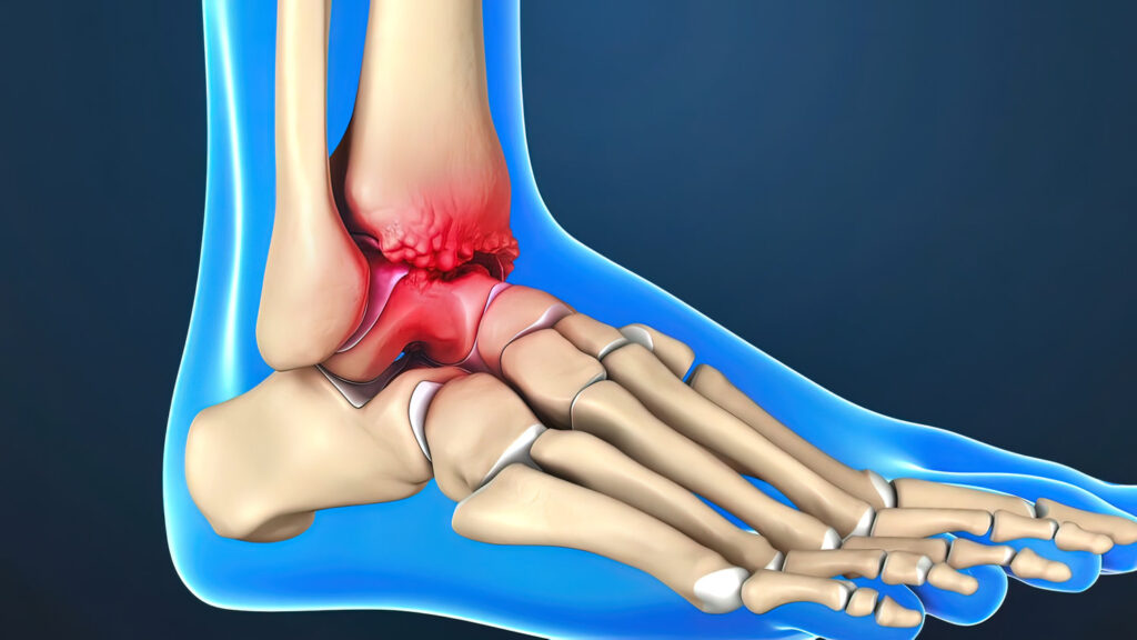 Foot and Ankle Specialist