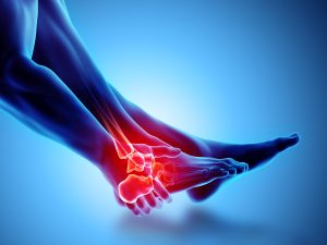 Back on Your Feet: A Complete Guide to Broken Ankle Treatment in Rajkot from a Leading Foot and Ankle Specialist Doctor